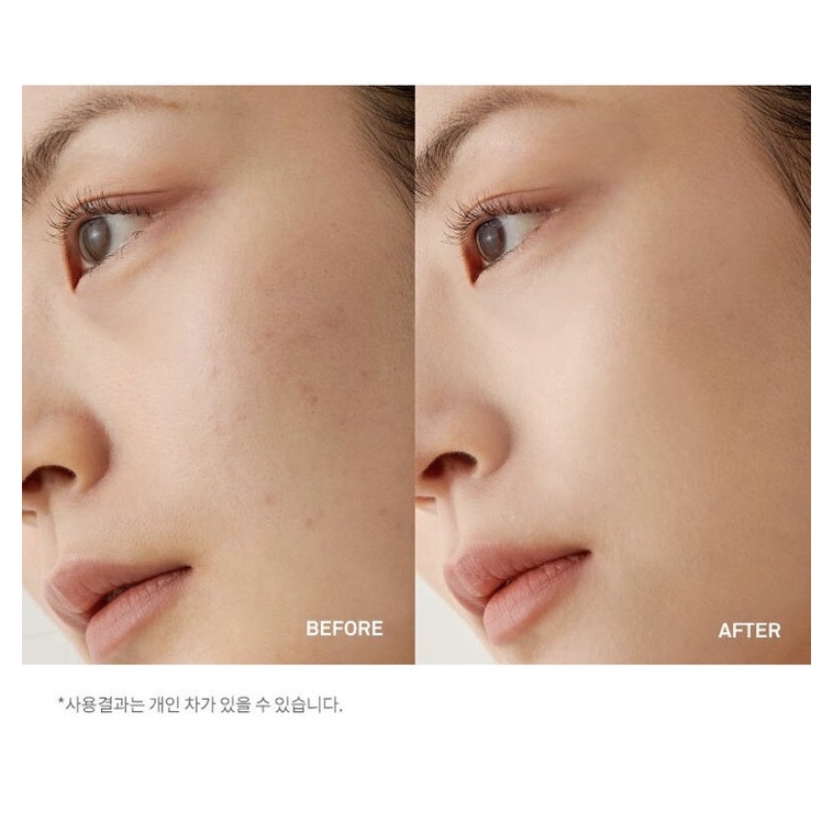 Che Khuyết Điểm Hince