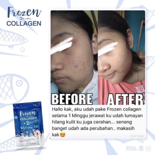 Viên uống trắng da collagen prozen x10