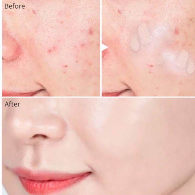 Kem Che Khuyết Điểm Che Mụn Quầng Thâm Tàn Nhang Novo | BigBuy360 - bigbuy360.vn