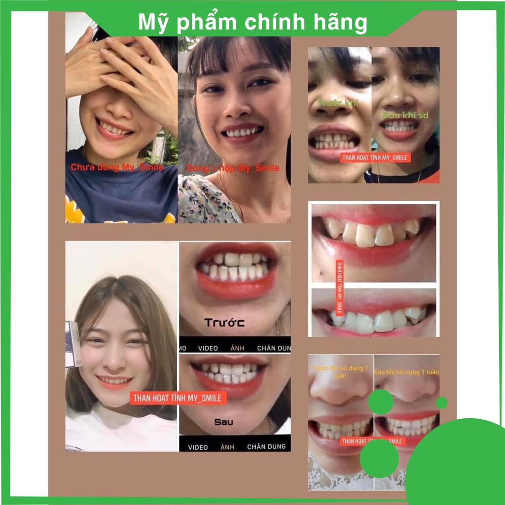 [CHÍNH HÃNG] - Trắng răng than hoạt tính My Smile 70gr, bột đánh răng làm trắng răng từ than hoạt tính