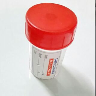 Lọ đựng mẫu bệnh phẩm 50ml