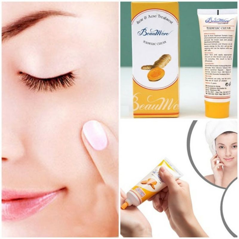 Kem Nghệ Chống Mụn và Sẹo Thâm BEAUMORE Turmeric Cream