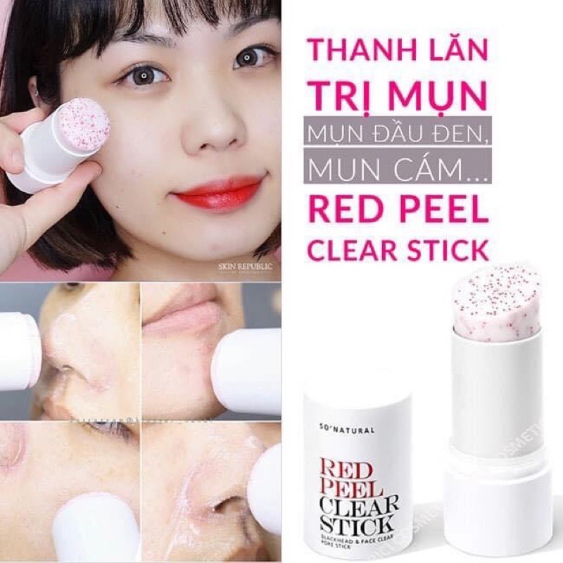Thanh lăn Red Peel Clear Stick