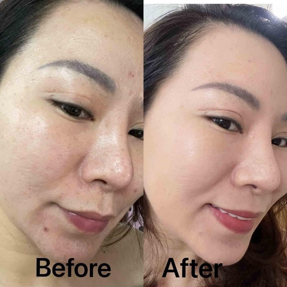 Kem Nám DongSung Miskos Prestige Whitening Cream 50g