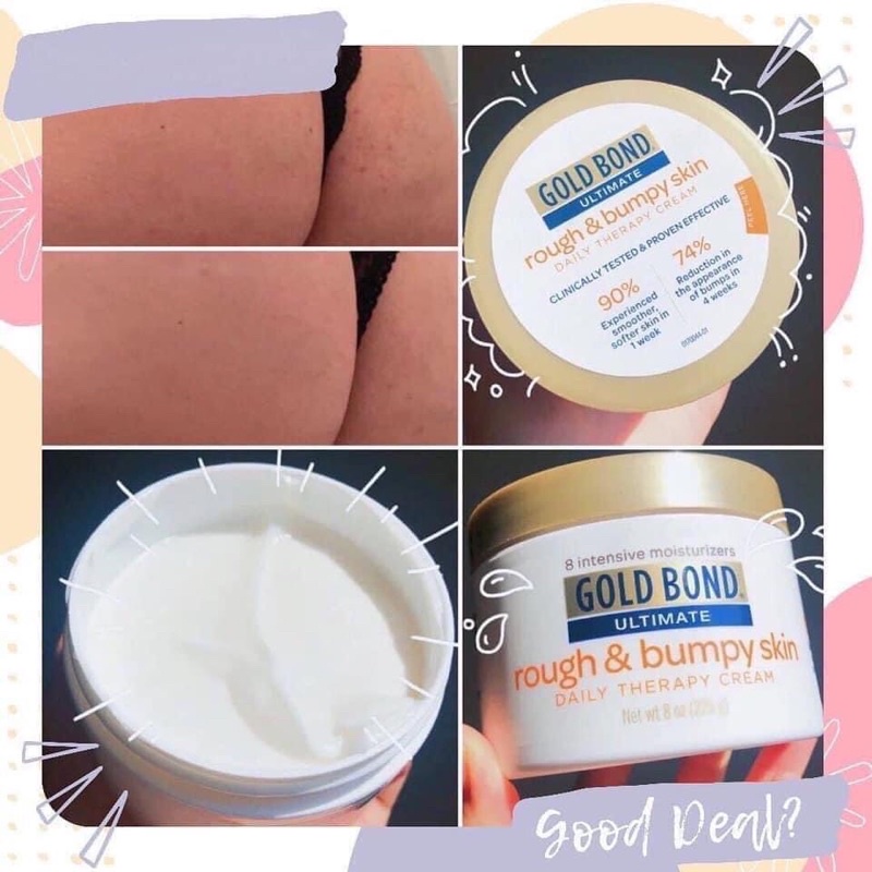 SẴN KEM CỔ KEM MÔNG BOLD BOND