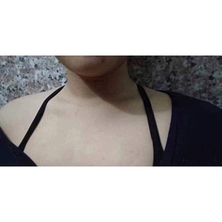 Xà phòng ngừa mụn lưng for back