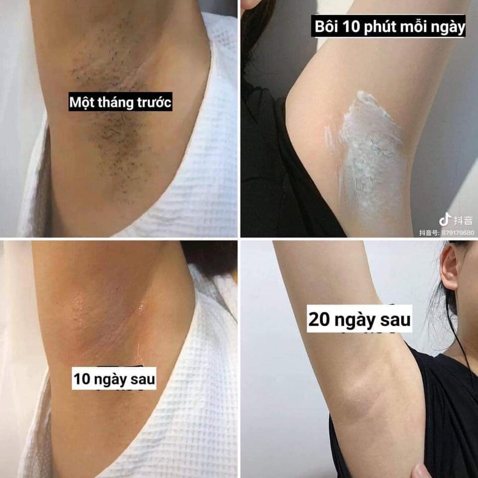 KEM DƯỠNG TRẮNG GIẢM THÂM VÙNG DƯỚI CÁNH TAY ALPHA ARBUTIN THÁI LAN
