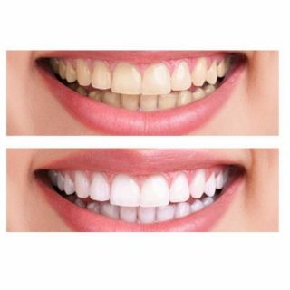Combo 02 tuýp kem đánh răng White & White Nhật Bản