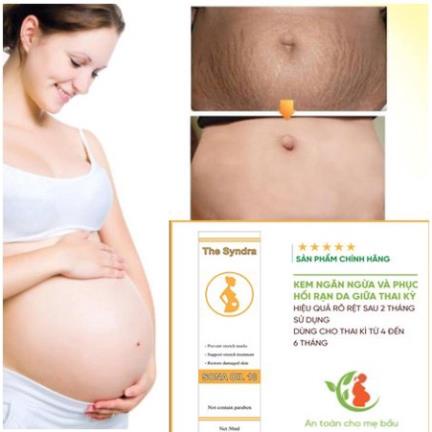 Dẩu rạn da chống rạn da cho bà bầu | BigBuy360 - bigbuy360.vn