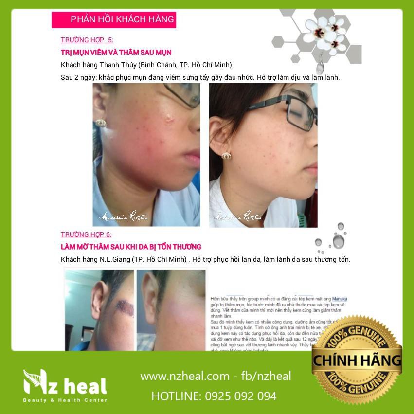 Kem Mật Ong Manuka 18+ Giảm Mụn, Mờ Thâm, Làm Dịu Da Dị Ứng Skin Health Crème hàng chính hãng | BigBuy360 - bigbuy360.vn