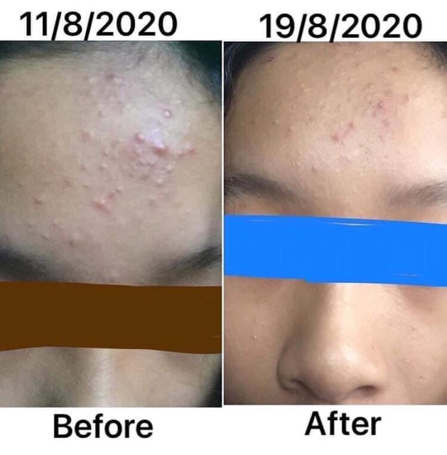 [MUA 1 TẶNG 4] - LEMON MASK KHỔ QUA RỪNG | BigBuy360 - bigbuy360.vn