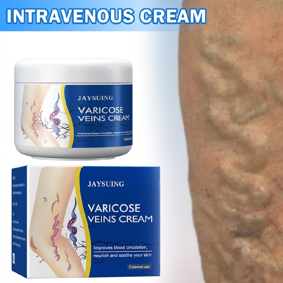 50g Vein Care Fading Cream Varicose Veins Cream for Legs Veins Herbal Ointment