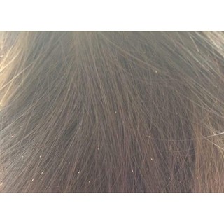 lược chải chí