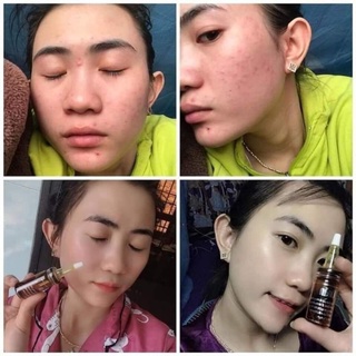 serum noãn thực vật (chính hãng)