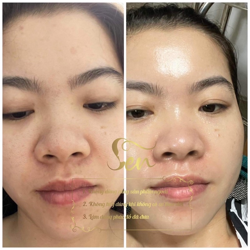 Kem Face Dưỡng Da Mặt Dược Phẩm Sen - Dưỡng Trắng Tái Tạo Căng Bóng - 30Gr