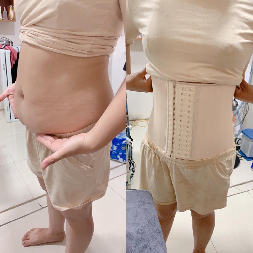 Gen định hình chính hãng 100% cao su non - Gen Latex nhập khẩu Hy Lạp - Đai định hình chống cuộn | BigBuy360 - bigbuy360.vn