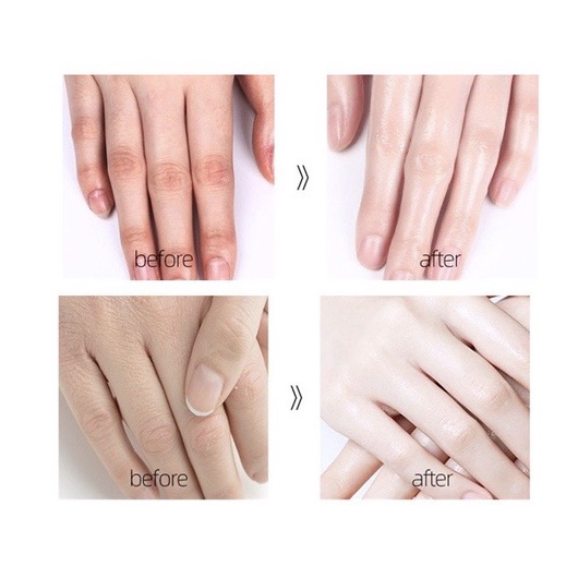 Serum YINBA Dưỡng Ẩm Làm Mềm Da Tay Cao Cấp 30g