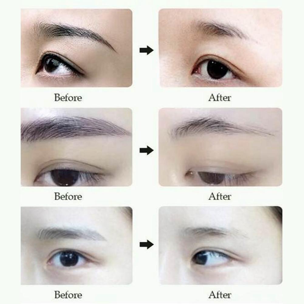 [Hàng mới về] Kem xóa mờ hình xăm chất lượng cao an toàn tiện dụng