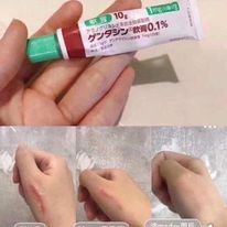 Kem sẹo / Kem mụn ẩn nhật bản 10g