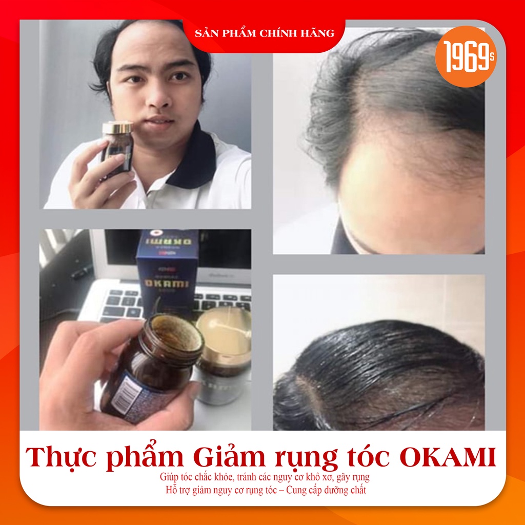 Viên uống hỗ trợ kích mọc tóc OKAMI Nhật Bản ngăn rụng, nuôi dưỡng phục hồi nang tóc khỏe 180 viên - 1969s Việt Nam
