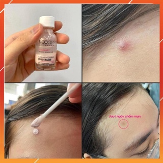 Chấm Mụn Neogen 2 Lớp Xẹp Mụn Sau 4H 15ml