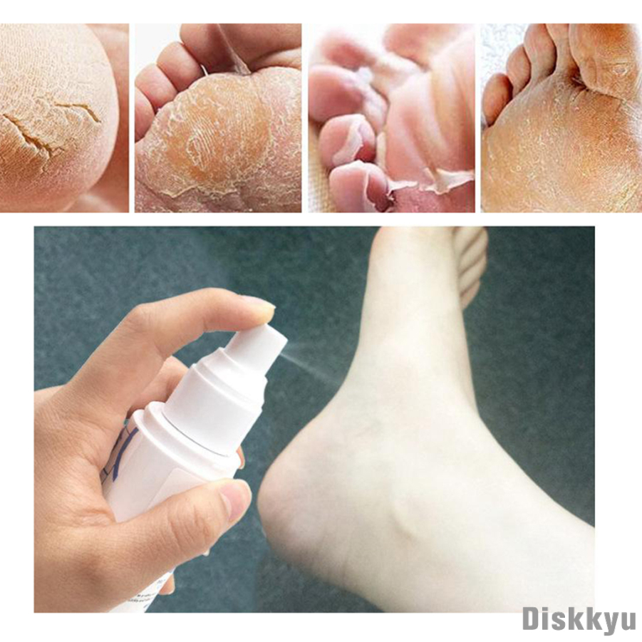 ELEVEN EVER Foot Callus Softener,Softens Dry, Dead, Hard, Cracked Skin & Calluses Foot Softener, 80ml/2.7fl.oz