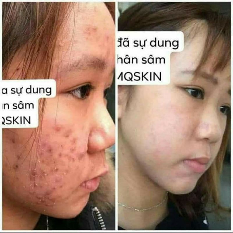 Serum Tái Tạo Da Nhân Sâm  MQ 80ml | BigBuy360 - bigbuy360.vn