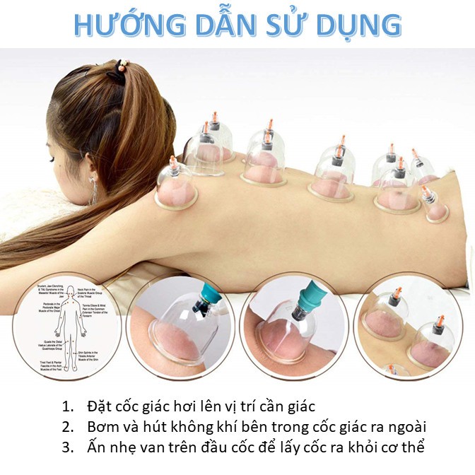 Bộ giác hơi không dùng lửa, giác hơi chân không loại tốt 12 cốc (hộp vàng)