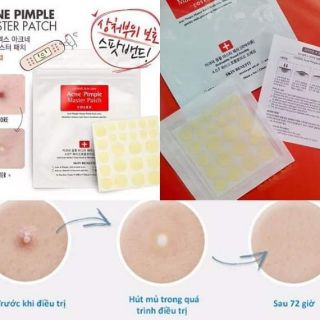 Miếng dán giảm mụn Cosrx Acne Pimpke Master Patch