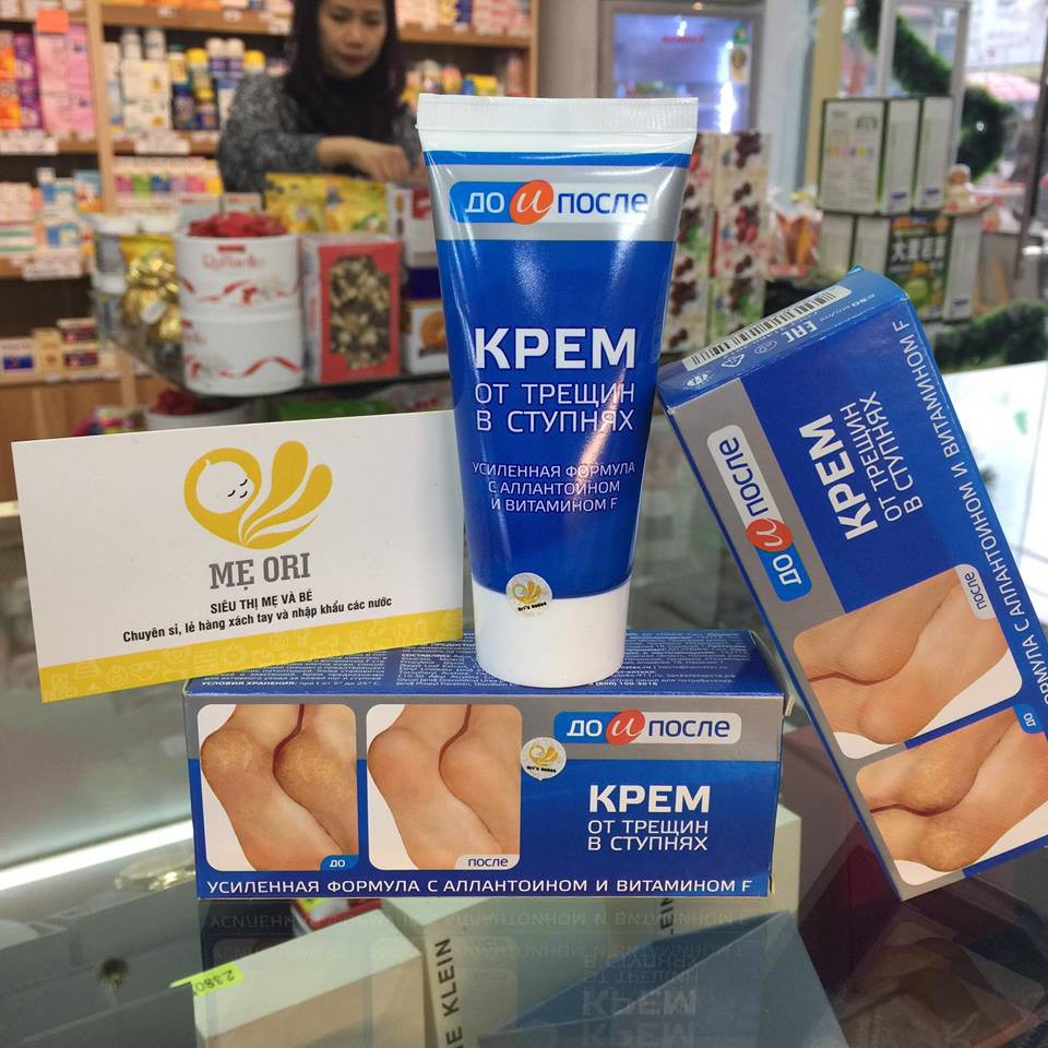 Kem trị nứt gót chân Kpem TEMA 50ml - Nga