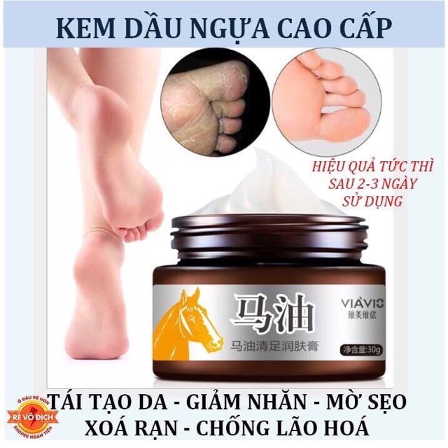 Kem cao ngựa trị nứt gót chân