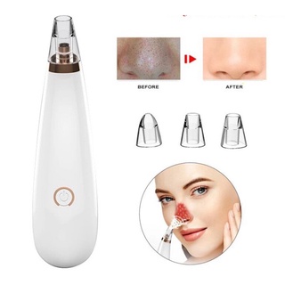Máy hút mụn cầm tay mini - hút mụn đầu đen, mụn cám