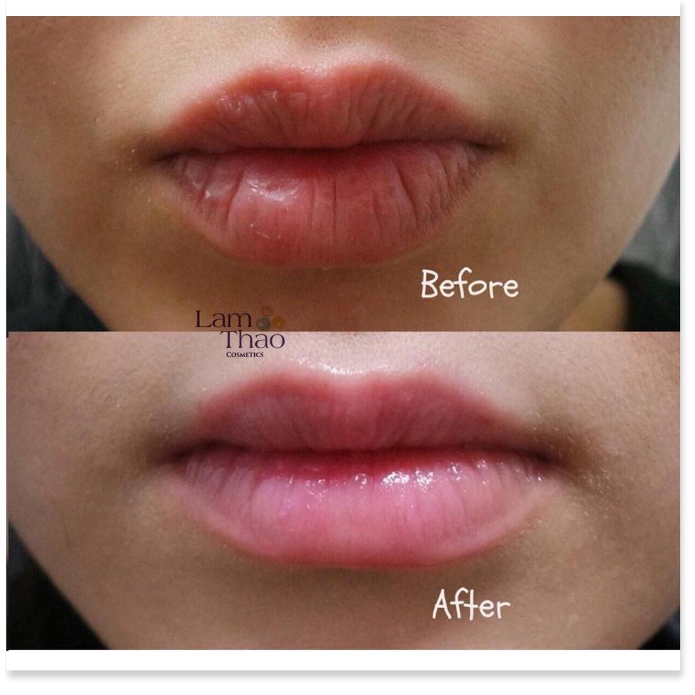 [Mã giảm giá] Serum làm căng và dưỡng môi Hyaluron Lip Push-up Serum Eveline