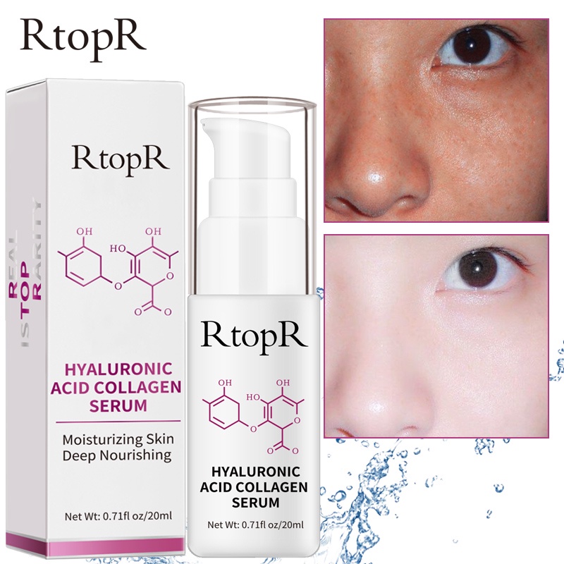 Tinh Chất Dưỡng RtopR Từ Hyaluronic Acid Collagen Hỗ Trợ Giảm Mụn Chống Nếp Nhăn Làm Trắng Da 20ml