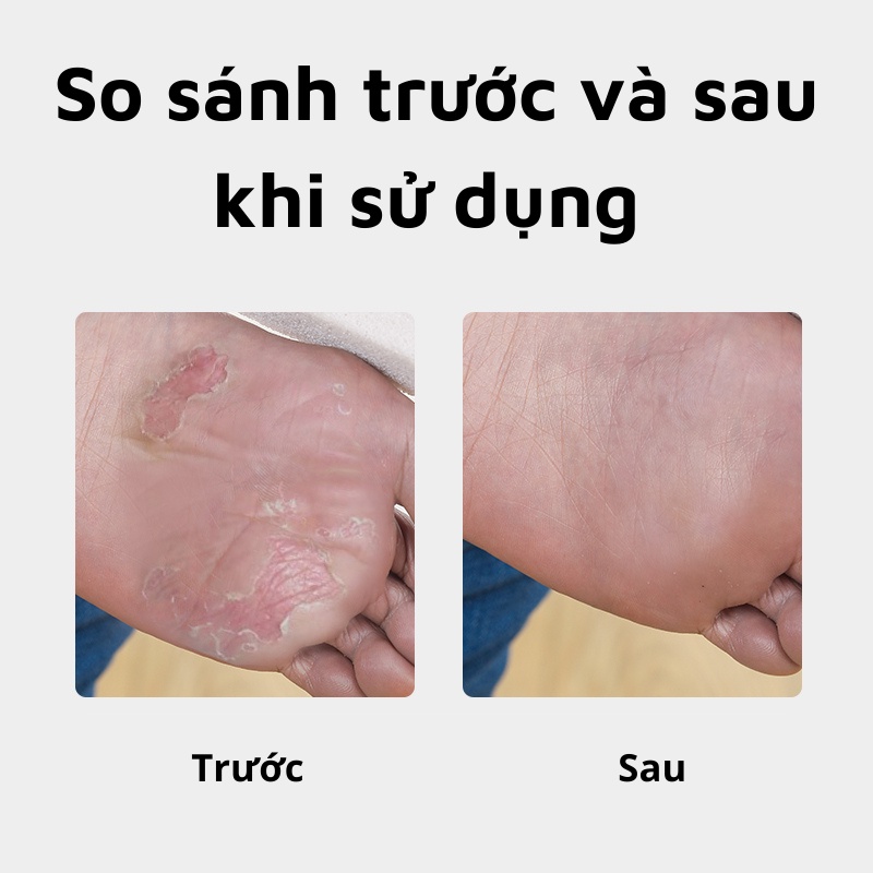 Chà Gót Chân Đá Bọt San Hô Nhật Bản Làm Sạch Tế Bào Chết Cho Da Mịn Màng Trắng Hồng Quyến Rũ