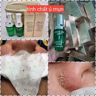 Ủ mụn younger chính hãng chuyên dùng cho spa