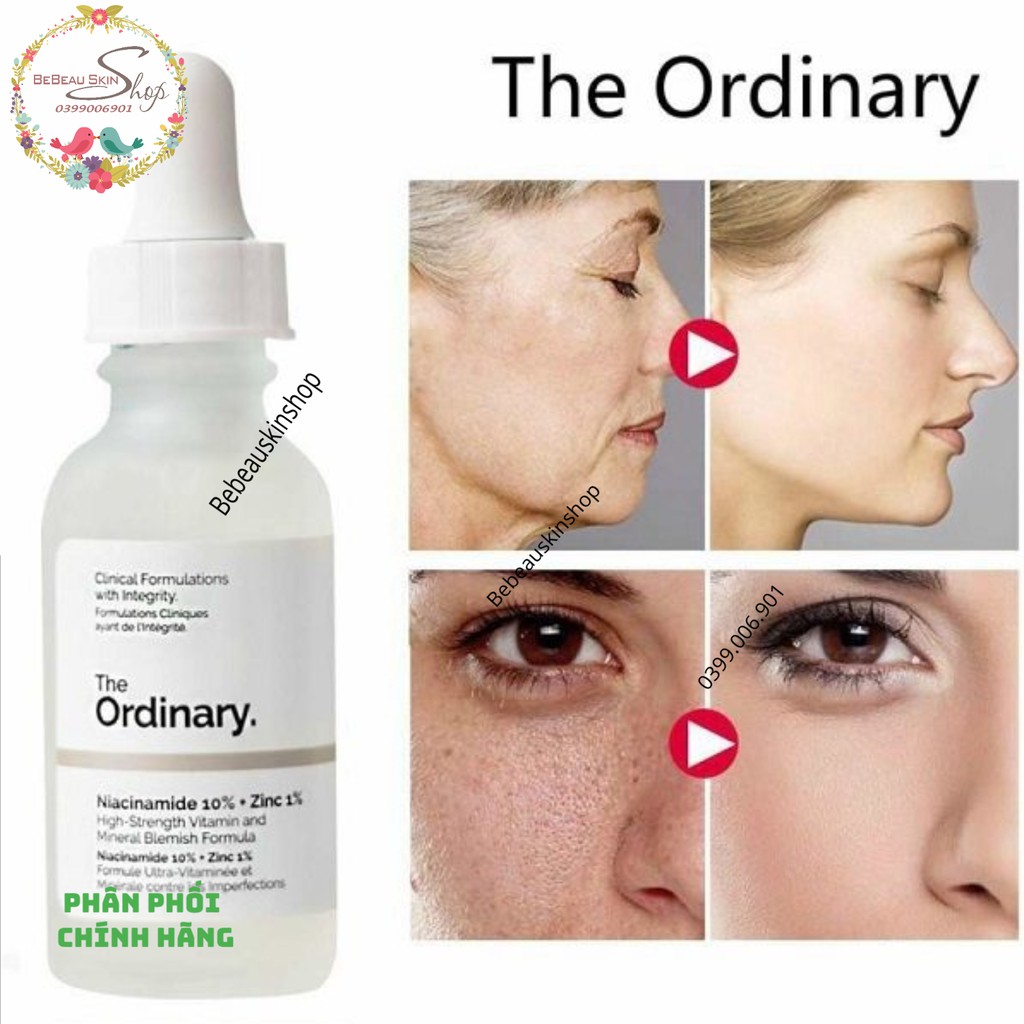 Tinh chất The Ordinary Niacinamide 10% + Zinc 1% giảm mụn, thu nhỏ lỗ chân lông - Bebeau Skin Shop