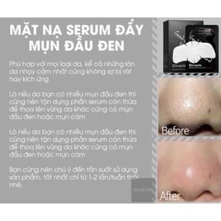 Miếng dán mụn đầu đen Ciracle GOODBYE BLACKHEAD