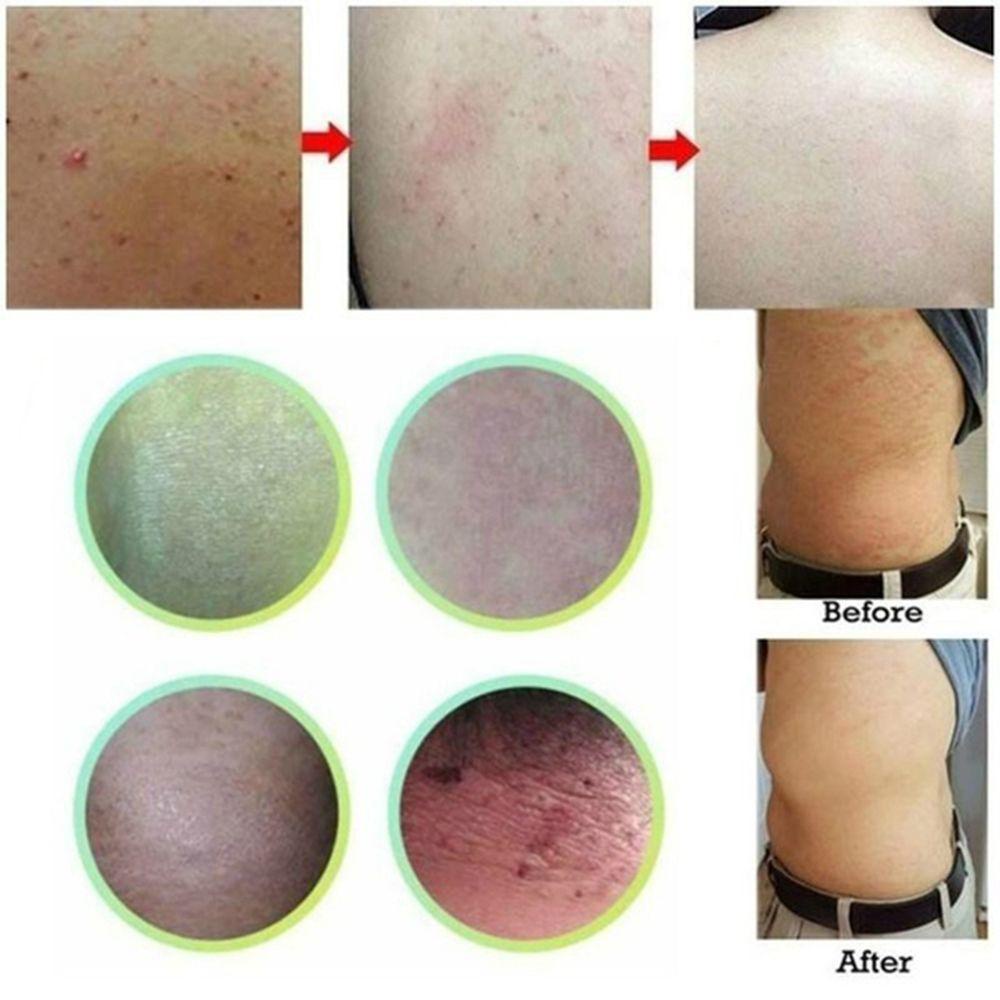 Xà Phòng Rửa Mặt 7g Dưỡng Ẩm Chống Nắng Kiểm Soát Dầu Kháng Khuẩn