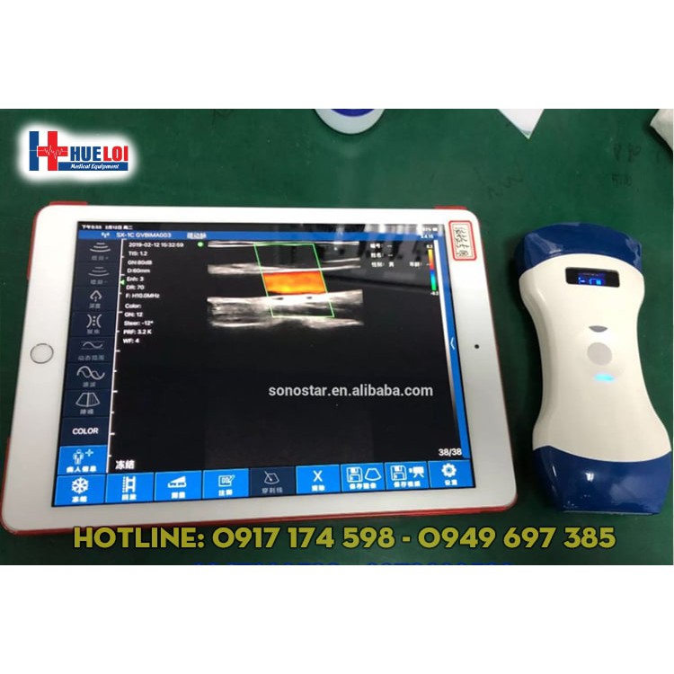 MÁY SIÊU ÂM KẾT HỢP HAI LOẠI ĐẦU DÒ