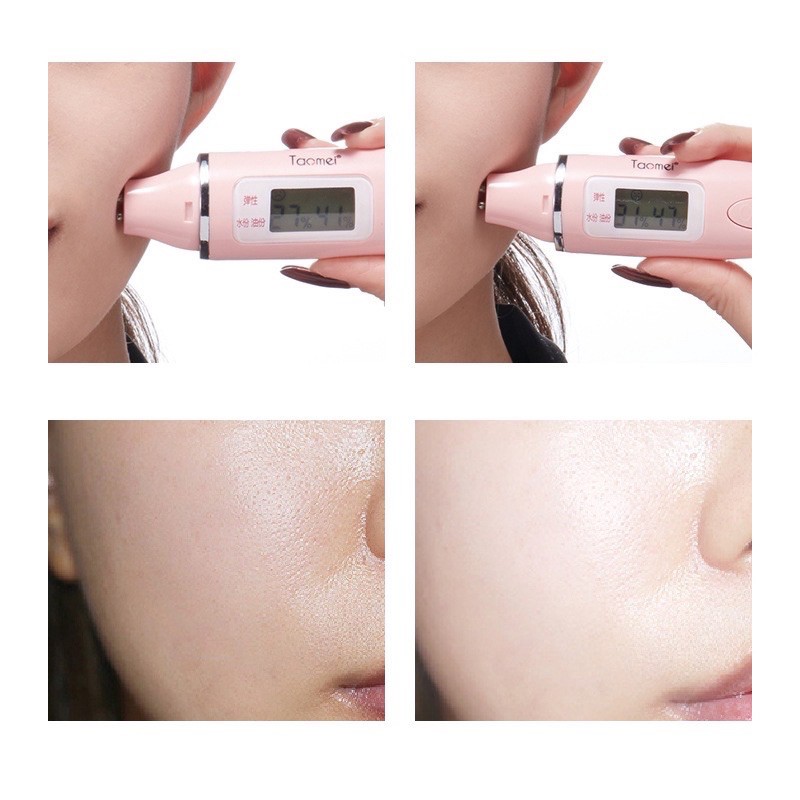 Măt nạ bóng đèn hồng Venzen dưỡng ẩm trẻ hóa da nội đia Trung 2ml A016