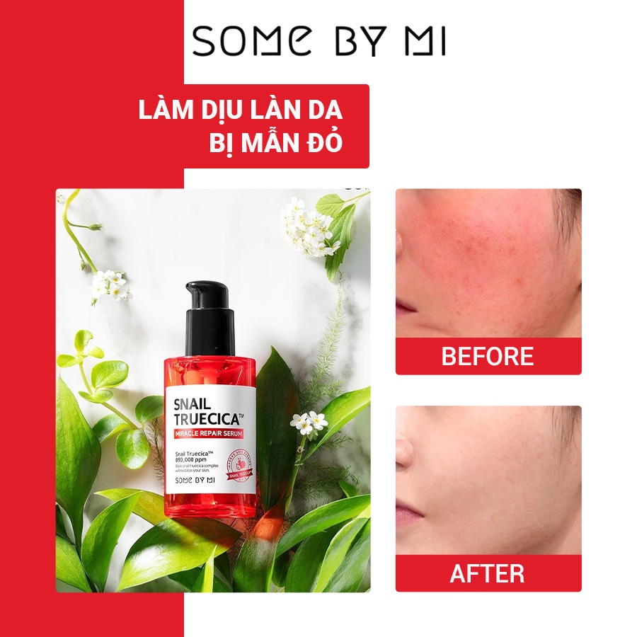 Tinh chất ốc sên đen cải Thiện sẹo mụn Some By Mi Snail Truecica Miracle Repair 50ml