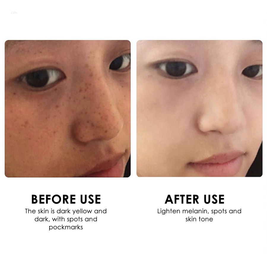 Tinh Chất Làm Trắng Da Dưỡng Ẩm Loại Bỏ Đốm Đen Hiệu Quả 30
