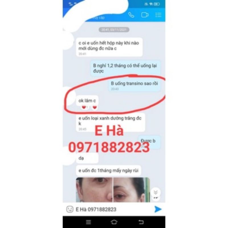Viên trắng da, chống nám, chống tàn nhang Transino 240 viên Nhật Bản