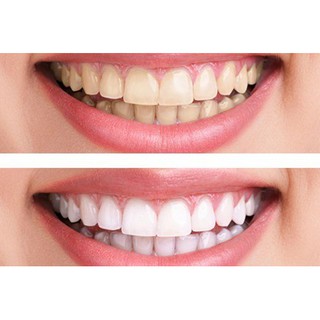 [Quinshop.vn] Kem Đánh Trắng Răng Crest 3D White Toothpaste