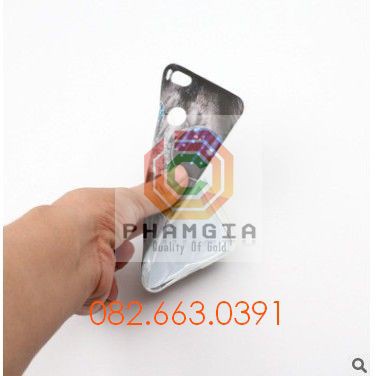 Ốp lưng Xiaomi Mi 5x dẻo in hình đẹp (p2)