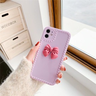 Ốp iphone gắn Nơ dành cho Iphone XS Max/11/11Pro Max/12Pro/12Pro Max