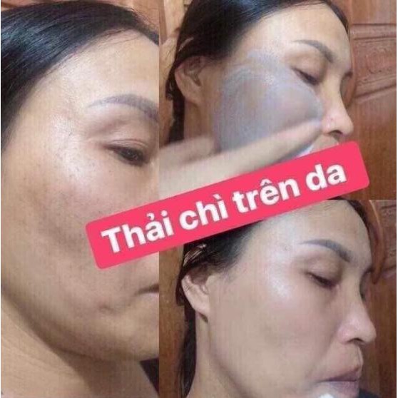 OL- CELL Kem THẢI NÁM 🌸 có hạt massage Hàn Quốc [ CÓ TEM CHỐNG GIẢ LÀ HÀNG GIẢ ] | BigBuy360 - bigbuy360.vn