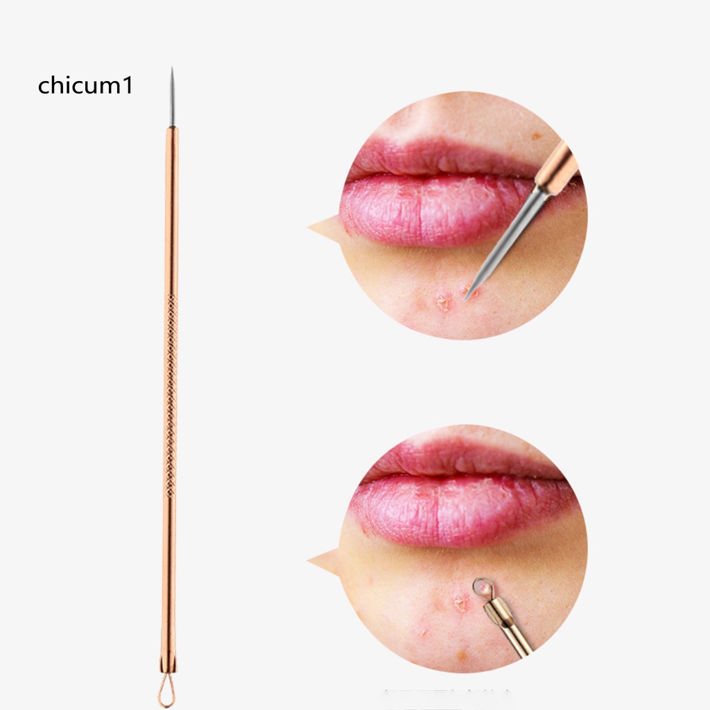 Set 4 Dụng Cụ Nặn Mụn Đầu Đen An Toàn Tiện Dụng