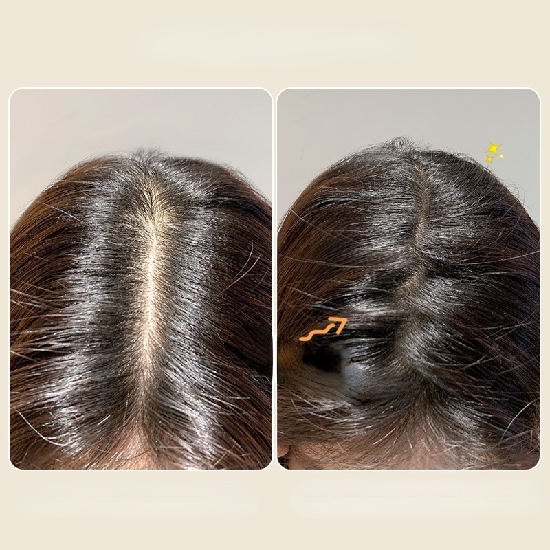 Lược chữ Z chải tóc tạo kiểu thời trang phong cách Hàn Quốc tùy chọn màu sắc yrshop